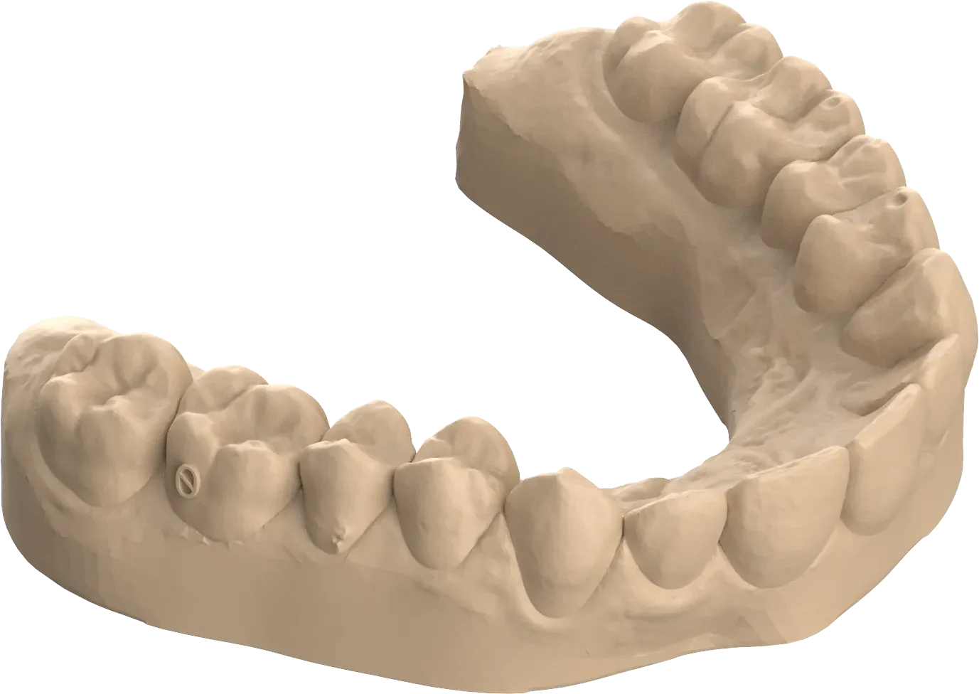 Dental 3D Printing