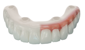 Hybrid_Denture_half_Characterized (3)