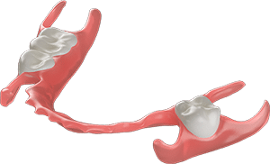 SprintRay-Apex-Flex-Cloud-Design-flexible-partial-tiny