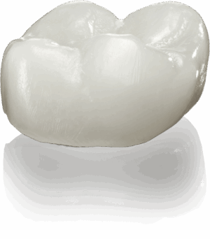 sprintray-midas-crown-restore-retoration-3d-dental-300x342