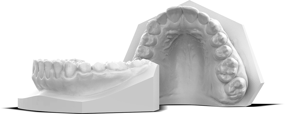 Sprintray Study Models White Fda Material Waxup 3d Print