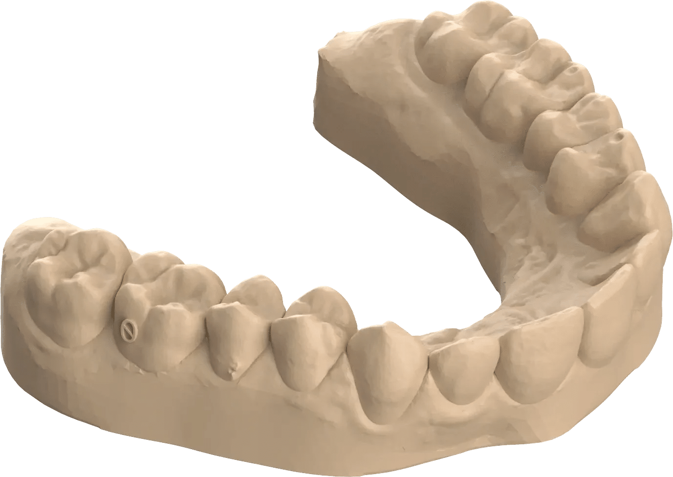 Dental Models E1680000138896