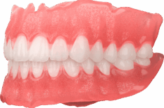 sprintray-apex-base-teeth-denture-removable-right-min-235x155
