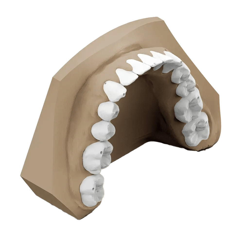 Provisionals And Wax Ups