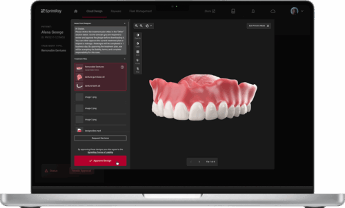 sprintray-cloud-design-laptop-software-denture-partial-500x302 sprintray-cloud-design-laptop-software-denture-partial-500x302