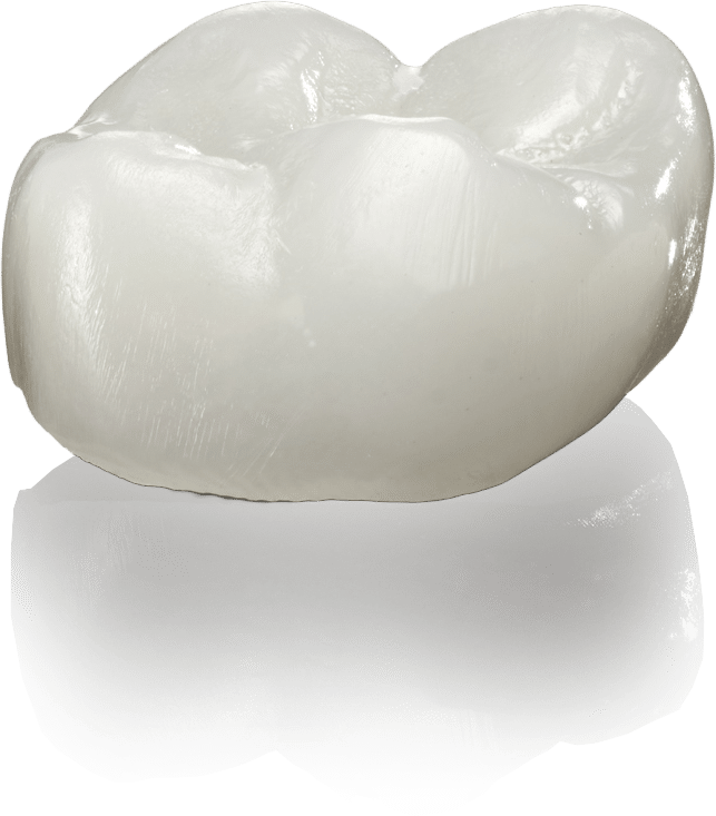 sprintray-midas-crown-restore-retoration-3d-dental