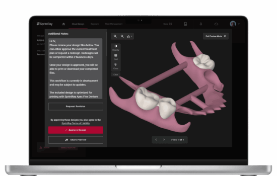 sprintray-cloud-design-laptop-software-partial-flexible-denture-scaled sprintray-cloud-design-laptop-software-partial-flexible-denture-scaled