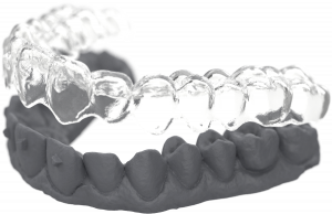 Sprintray Materials Die Model Gray Resin Hero Aligner