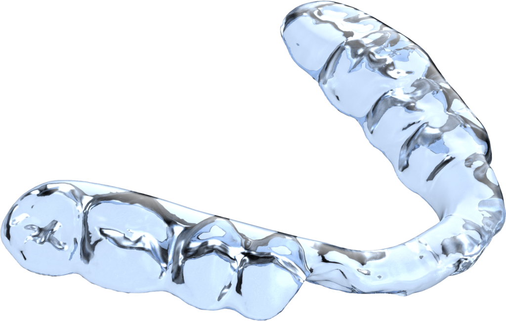 sprintray-cloud-design-ai-expert-nightguard-Anterior-Coverage