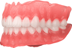sprintray-apex-base-teeth-denture-removable-right-min
