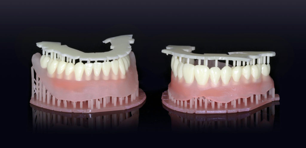 3d printed dentures