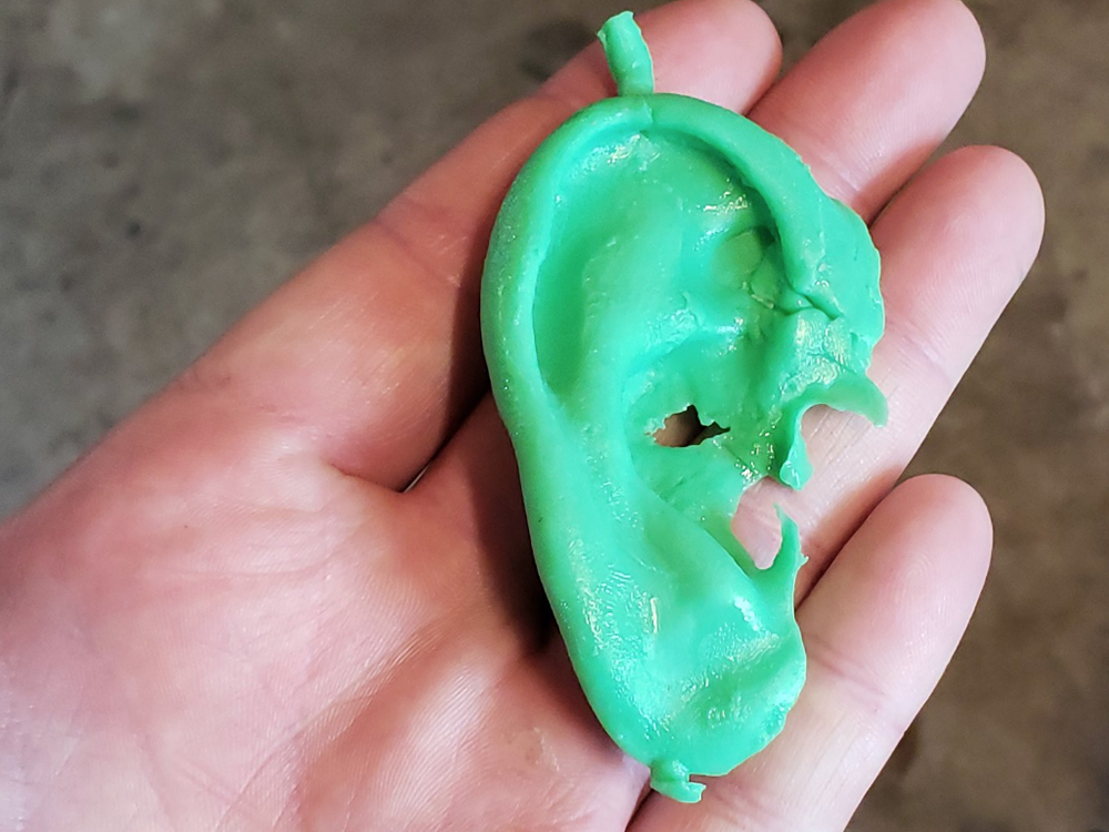 3d printed prosthetic ear