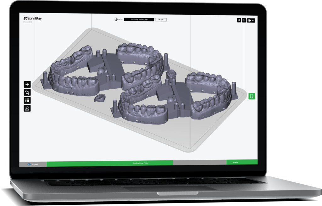 dental 3D printing software