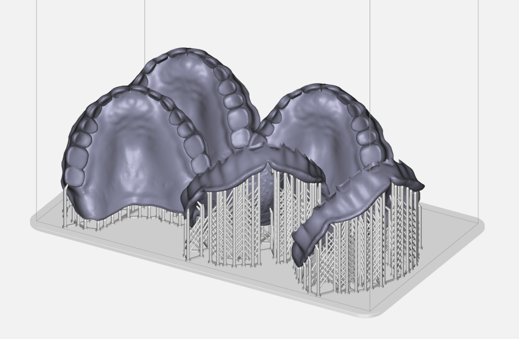 Standing 3D dentures in 3D printing software