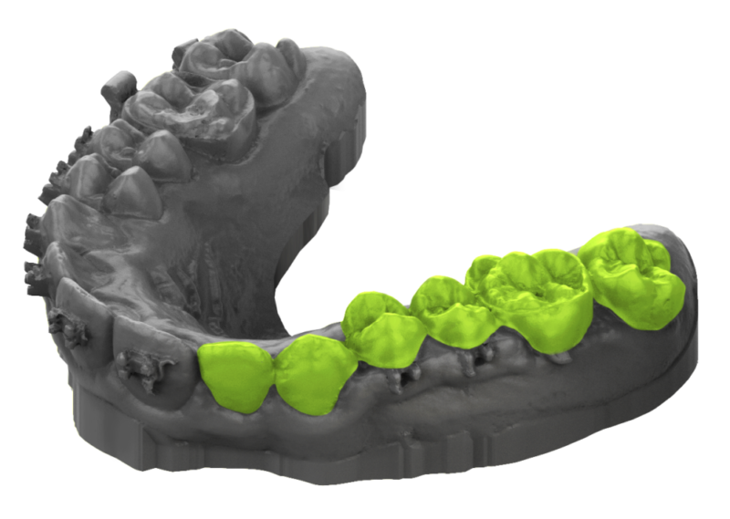 3D Print Clear Aligners