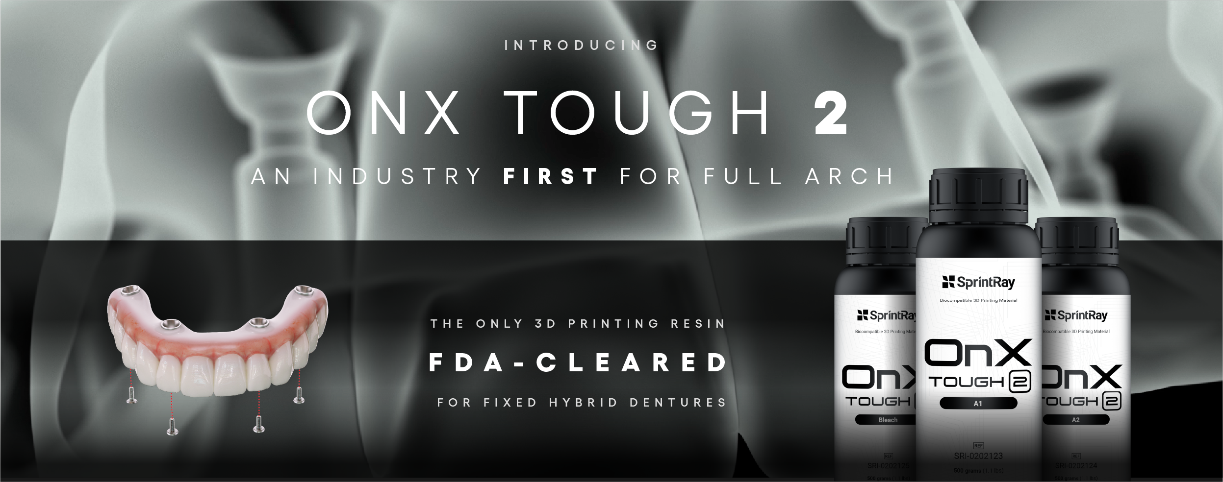 Introducing OnX Tough 2: The First 3D Printing Resin FDA Cleared for Fixed  Hybrid Dentures - SprintRay Inc.