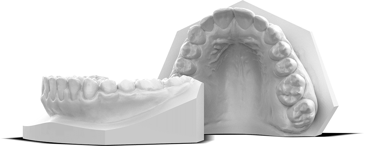 Modèles d'étude et modèles dentaires