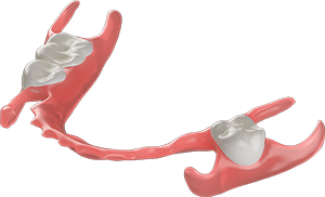 Flexible Partial Dentures