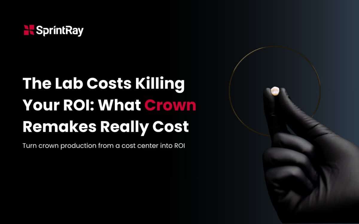 The Lab Costs Killing Your ROI: What Crown Remakes Really Cost